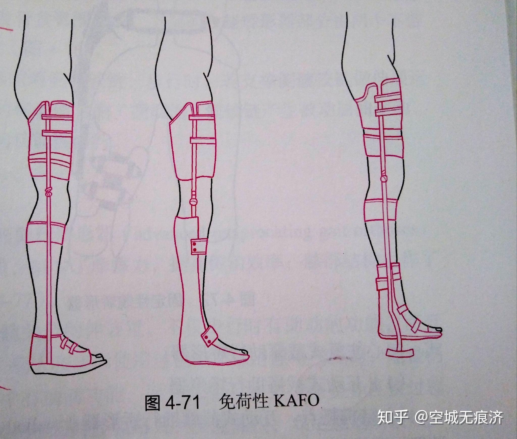 臨床康復工程學 假肢與矯形器的功能、設計與發展